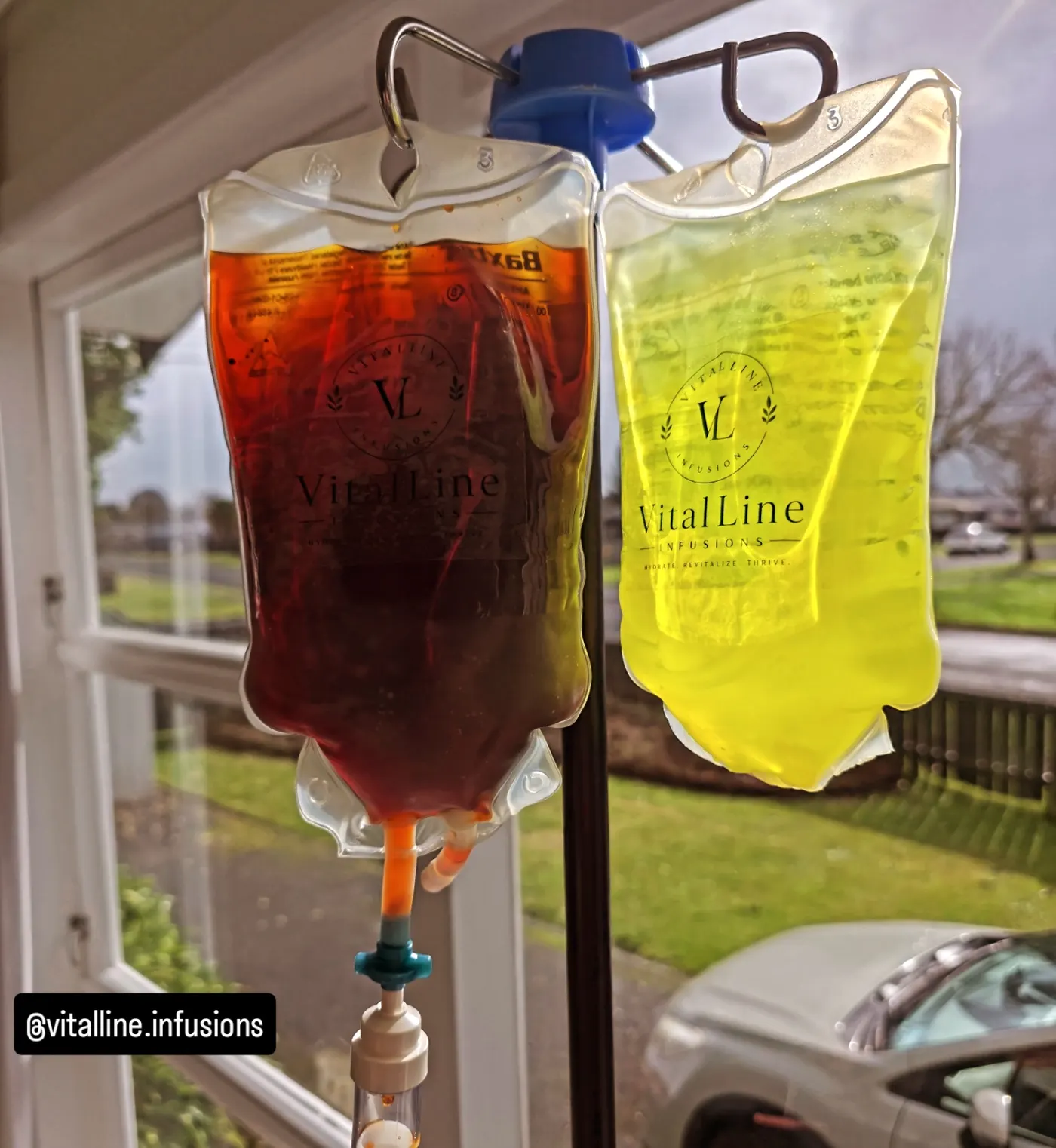 A VitalLine Infusions iron infusion (amber) hanging beside a wellness infusion (yellow), prepared at a client's home in the Waikato.